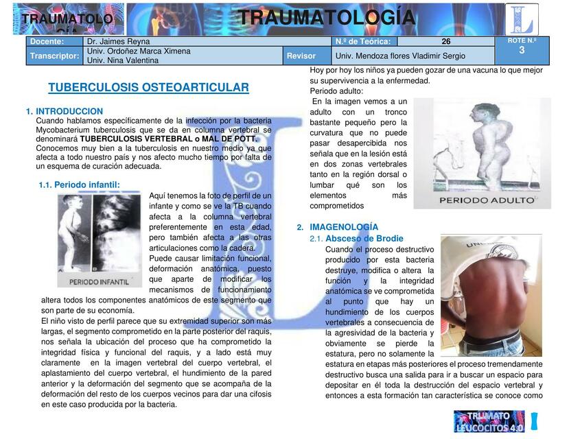 TR3 T26 TUBERCULOSIS OSTEOARTICULAR 1