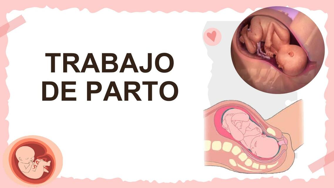 trabajo de parto obstetricia