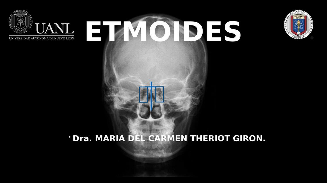 4 Etmoides