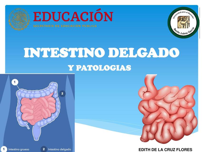 Intestino Delgado EDITH