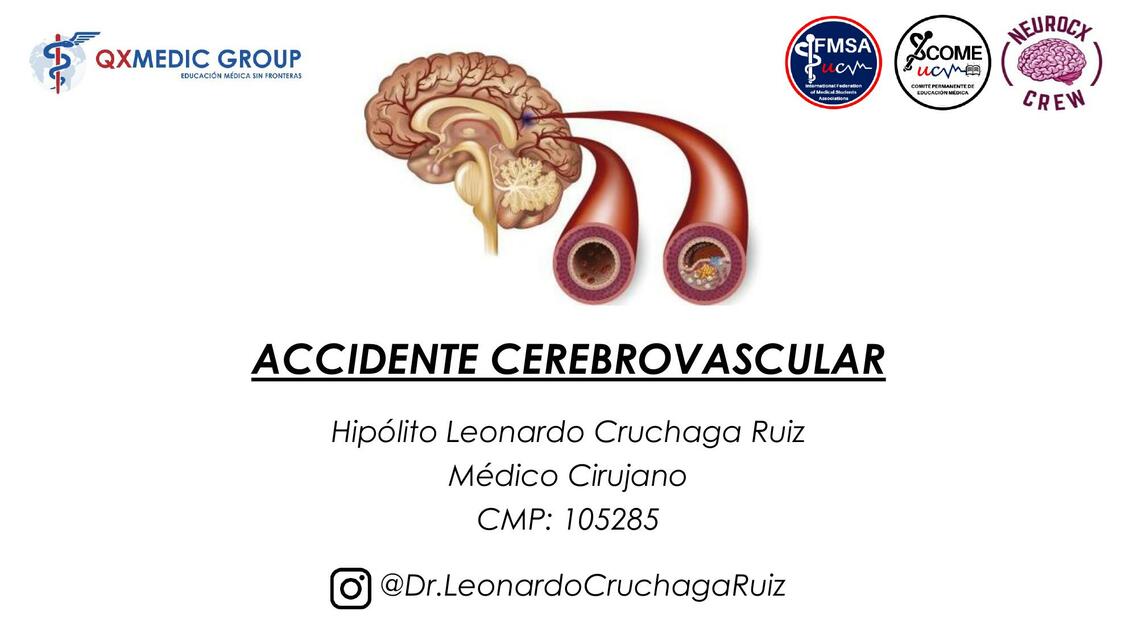 ACCIDENTE CEREBROVASCULAR LEONARDO CRUCHAGA