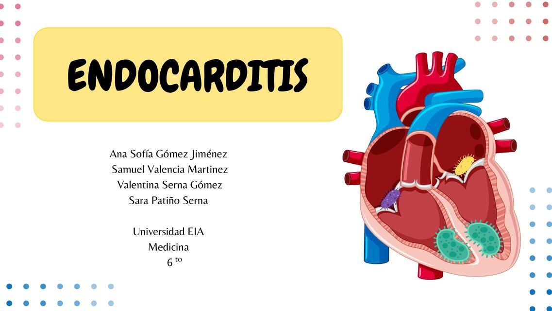 Pericarditis